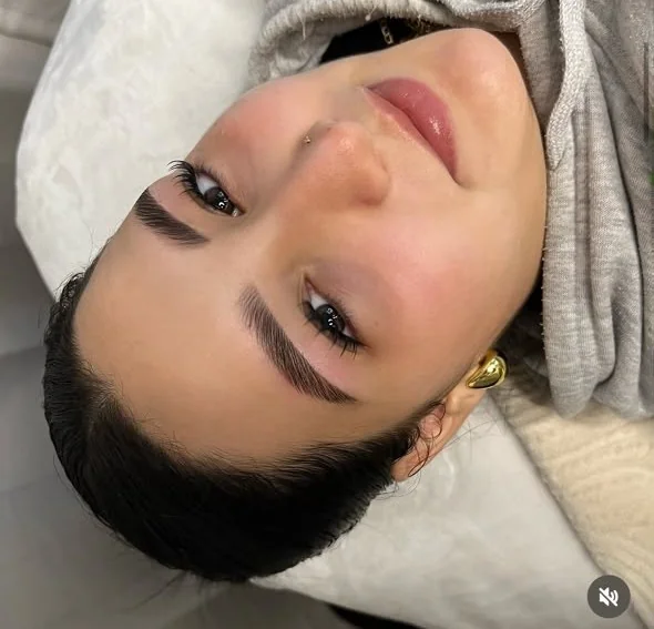 Cejas alineadas tras un laminado
